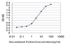 Anti-MARCH7 Mouse Monoclonal Antibody [clone: 2B9]