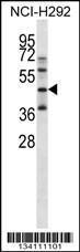 Anti-KLF1 Rabbit Polyclonal Antibody (AP (Alkaline Phosphatase))