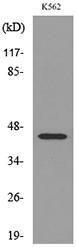 Western blot analysis of lysate from K562 cells using Anti-IL5RA Antibody