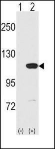 Anti-MVP Rabbit Polyclonal Antibody