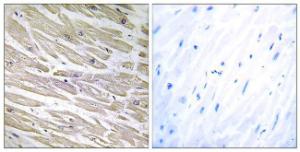 Immunohistochemical analysis of paraffin-embedded human heart tissue using Anti-LAMA4 Antibody. The right hand panel represents a negative control, where the antibody was pre-incubated with the immunising peptide.