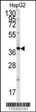 Anti-Endophilin B1 Rabbit Polyclonal Antibody (HRP (Horseradish Peroxidase))