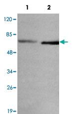 Anti-CTNNB1 Mouse Monoclonal Antibody