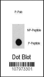 Anti-ABL1 Rabbit Polyclonal Antibody (HRP (Horseradish Peroxidase))