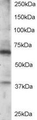 Anti-RGS14 Antibody (A84026) staining (0.5µg/ml) of Jurkat lysate (RIPA buffer, 35µg total protein per lane). Primary incubated for 1 hour. Detected by western blot using chemiluminescence.