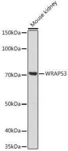 Western blot analysis of extracts of Mouse kidney, using Anti-WDR79 Antibody (A305478) at 1:1000 dilution. The secondary Antibody was Goat Anti-Rabbit IgG H&L Antibody (HRP) at 1:10000 dilution.