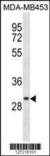 Anti-CCDC24 Rabbit Polyclonal Antibody (PE (Phycoerythrin))