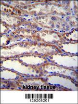 Anti-SHISA3 Rabbit Polyclonal Antibody (FITC (Fluorescein Isothiocyanate))