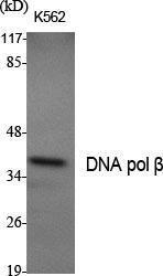 Western blot analysis of various cells using Anti-DNA Polymerase beta Antibody