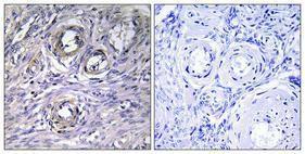 Immunohistochemical analysis of paraffin-embedded human ovary using Anti-ABHD12 Antibody 1:100 (4 °C overnight). The right hand panel represents a negative control, where the antibody was pre-incubated with the immunising peptide