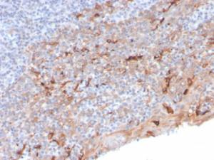 Immunohistochemical analysis of formalin-fixed, paraffin-embedded human tonsil using Anti-TIM3 Antibody [TIM3/3113]