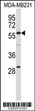 Anti-EHD1 Rabbit Polyclonal Antibody