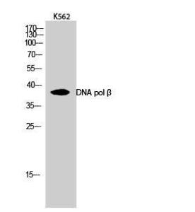 Western blot analysis of K562 cells using Anti-DNA Polymerase beta Antibody