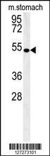 Anti-CORO6 Rabbit Polyclonal Antibody (HRP (Horseradish Peroxidase))