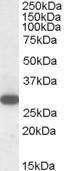 Anti-RGS18 Antibody (A84027) (1 µg/ml) staining of Human Peripheral Blood Mononucleocytes lysate (35 µg protein in RIPA buffer). Primary incubation was 1 hour. Detected by chemilu minescence