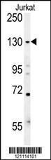 Anti-EHMT2 Rabbit Polyclonal Antibody (AP (Alkaline Phosphatase))