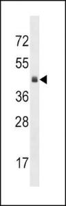 Anti-KLF12 Rabbit Polyclonal Antibody (AP (Alkaline Phosphatase))