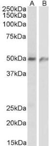 Anti-ECSM2 Antibody (A84028) (1 µg/ml) staining of Human lung (A) and Human Umbilical Cord (B) lysates (35 µg protein in RIPA buffer). Primary incubation was 1 hour