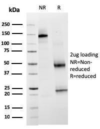 SDS-PAGE analysis of Anti-TIM3 Antibody [TIM3/3113] under non-reduced and reduced conditions; showing intact IgG and intact heavy and light chains, respectively. SDS-PAGE analysis confirms the integrity and purity of the Antibody