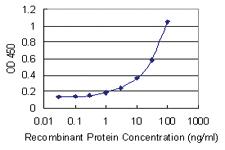 Anti-MARCH7 Mouse Monoclonal Antibody [clone: 4G3]