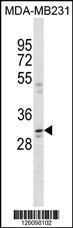 Anti-CCDC28A Rabbit Polyclonal Antibody (AP (Alkaline Phosphatase))