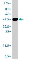 Anti-ZNF263 Mouse Polyclonal Antibody