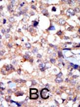 Anti-ABL1 Rabbit Polyclonal Antibody (FITC (Fluorescein))