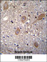 Anti-BTRC Rabbit Polyclonal Antibody (PE (Phycoerythrin))