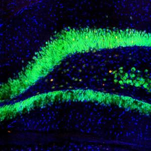 Section of rat hippocampus stained with Anti-c-Fos Antibody (red) and Anti-FOX3/NeuN Antibody (A85403 / green)