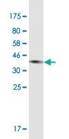 Anti-C3 Mouse Monoclonal Antibody [clone: X1]