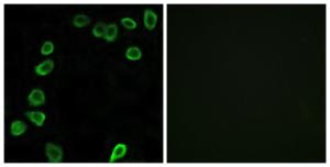 Immunofluorescence analysis of NIH/3T3 cells using Anti-LAMA4 Antibody. The right hand panel represents a negative control, where the antibody was pre-incubated with the immunising peptide.