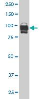 Anti-IFI16 Mouse Monoclonal Antibody [clone: 1B4]