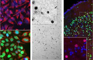 Anti-c-Fos Antibody staining (green) in HeLa cells, which were treated with serum-starvation for 36 hours, followed by 2 hours, 20% FBS stimulation (bottom panel), or PBS treatment (top panel)