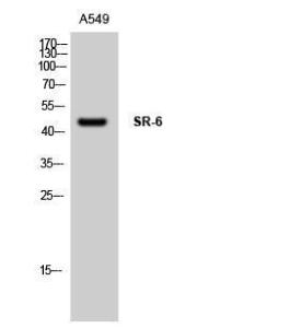 Western blot analysis of A549 cells using Anti-5-HT-6 Antibody