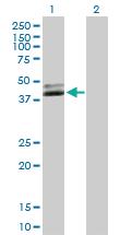 Anti-NUDT9 Mouse Polyclonal Antibody