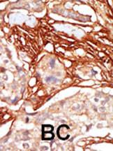 Anti-RAF Rabbit Polyclonal Antibody (AP (Alkaline Phosphatase))