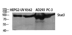 Western blot analysis of various cells using Anti-STAT3 Antibody