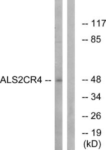 Western blot analysis of lysates from Jurkat cells using Anti-ALS2CR4 Antibody. The right hand lane represents a negative control, where the antibody is blocked by the immunising peptide.