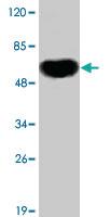 Anti-ESR1 Mouse Monoclonal Antibody