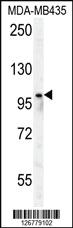 Anti-PARP8 Rabbit Polyclonal Antibody