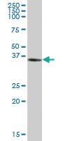 Anti-NUDT9 Mouse Polyclonal Antibody