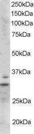 Antibody anti-LIME1 100 µg