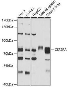 Anti-CD116 Rabbit Polyclonal Antibody