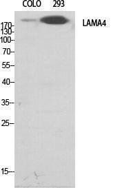 Western blot analysis of various cells using Anti-LAMA4 Antibody