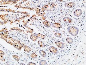 Immunohistochemical analysis of paraffin-embedded human colon using Anti-IL3RA Antibody