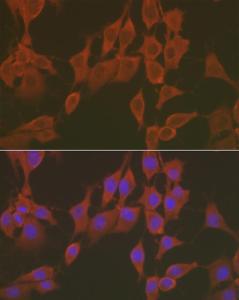 Immunofluorescence analysis of NIH/3T3 cells using Anti-FNDC5 Antibody (A305480) at a dilution of 1:100 (40X lens). DAPI was used to stain the cell nuclei (blue)