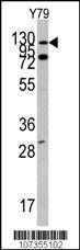 Anti-ABL1 Rabbit Polyclonal Antibody (HRP (Horseradish Peroxidase))