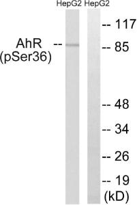 Western blot analysis of lysates from HepG2 cells using Anti-AhR (phospho Ser36) Antibody The right hand lane represents a negative control, where the antibody is blocked by the immunising peptide