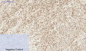 Immunohistochemical analysis of paraffin-embedded human uterus tissue using Anti-STAT3 Antibody at 1:200 (4 °C overnight). Negative control was secondary antibody only