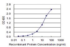 Anti-ZNF263 Polyclonal Antibody Pair